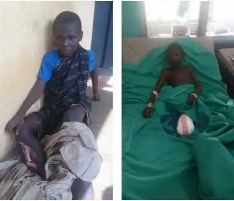 Horror: Grandfather Hacks 13-year-old Grandson's Leg with a Cutlass (Graphic Photos)
